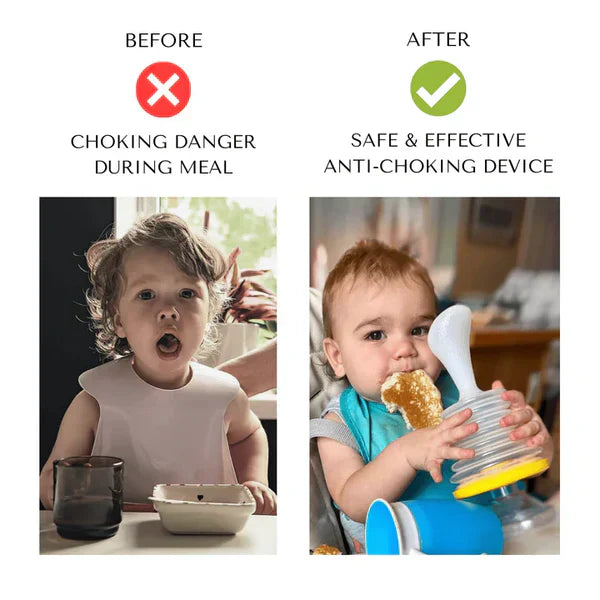 Gadgets™ ANTI-CHOKING DEVICE