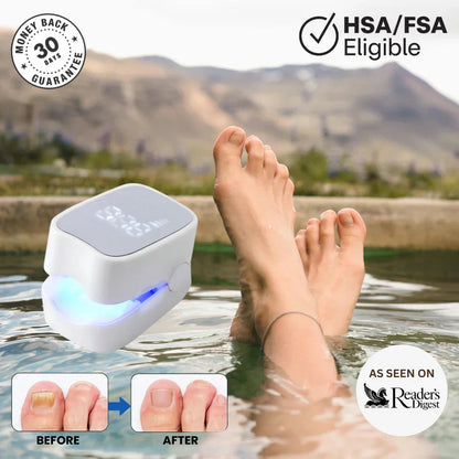 Gadgets™ - Nail Fungus Laser Device